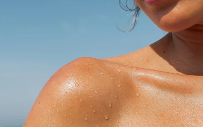 Les Canadiens moins prudents au soleil alors que les cas de cancer de la peau augmentent