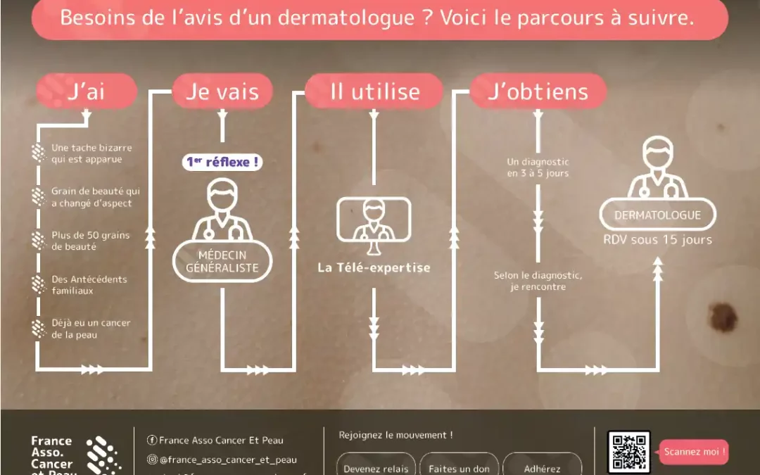 Une étude sur l&rsquo;efficacité de L&rsquo;I.A en dermatologie